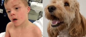 Down Sendromlu Çocuk ve Hayatını Kurtaran Aile Köpeği