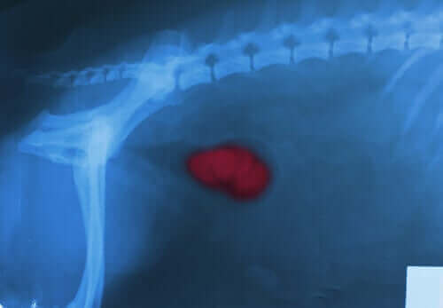 hematüri böbrek röntgeni